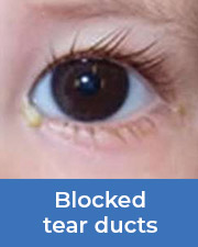 child with blocked tear ducts