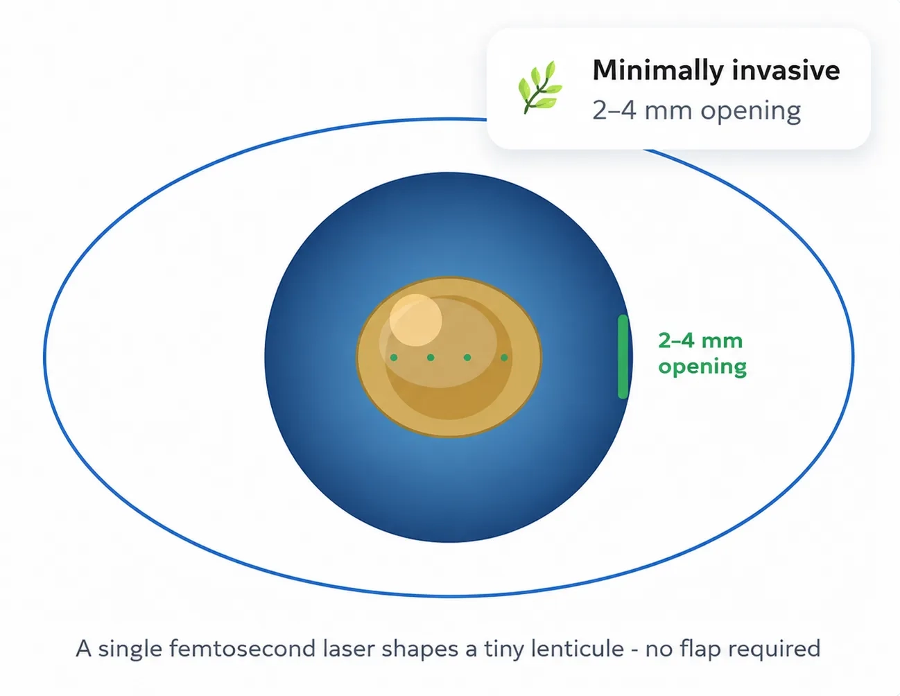 femtosecond-laser-img1