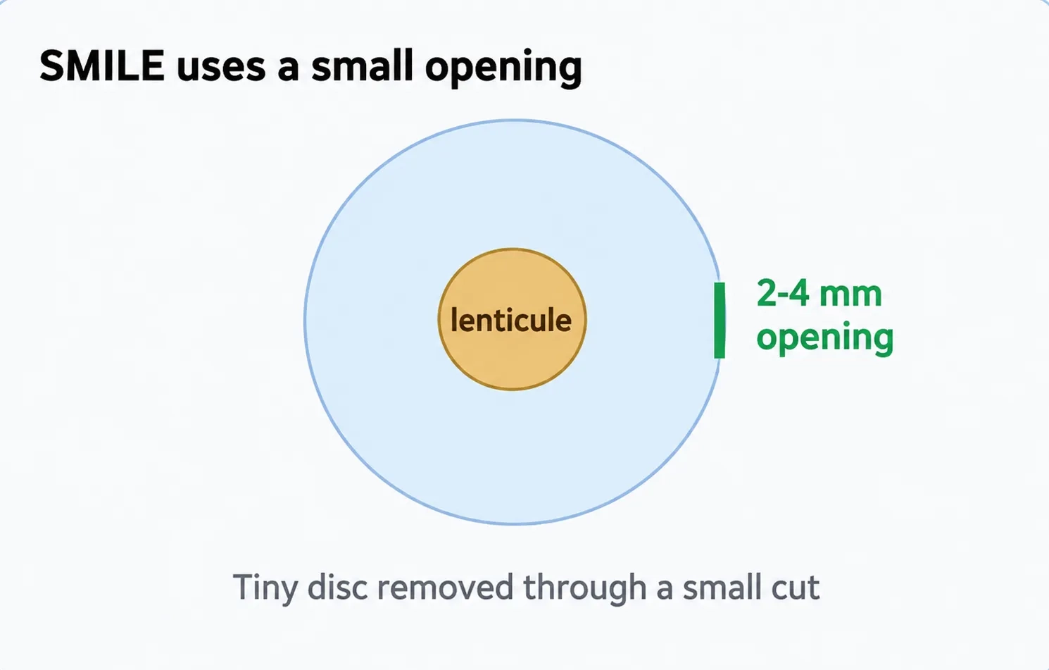 tiny-disc-removed-img3